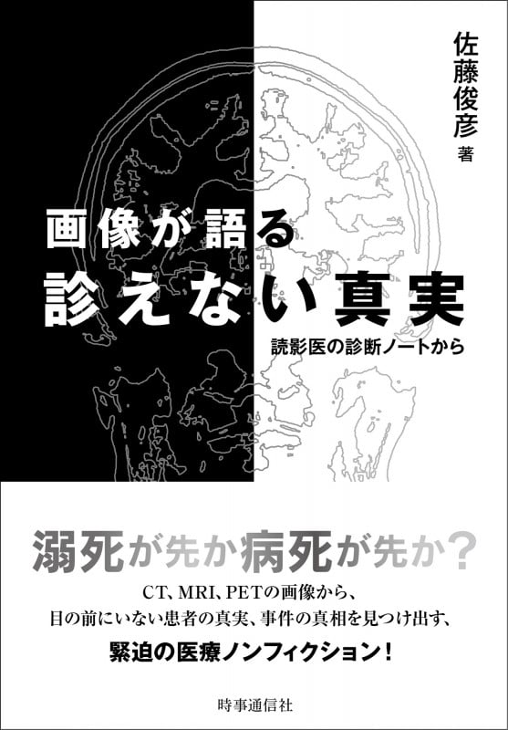 画像が語る診えない真実 読影医の診断ノートからの写真